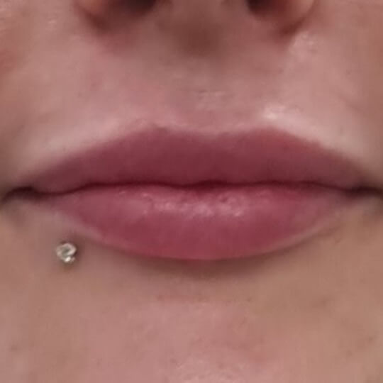 angie lips after compressed