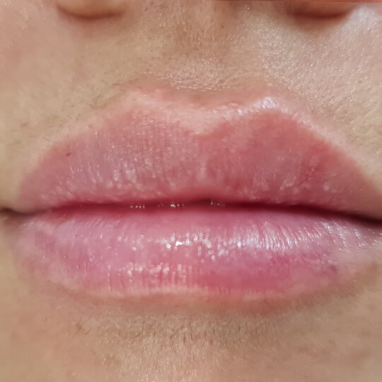 lips10 compressed