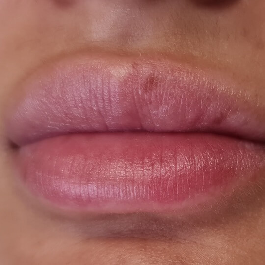 lips12 compressed