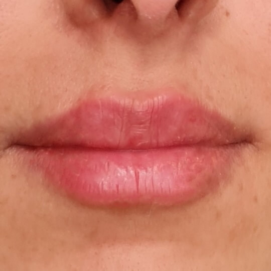 lips18 compressed