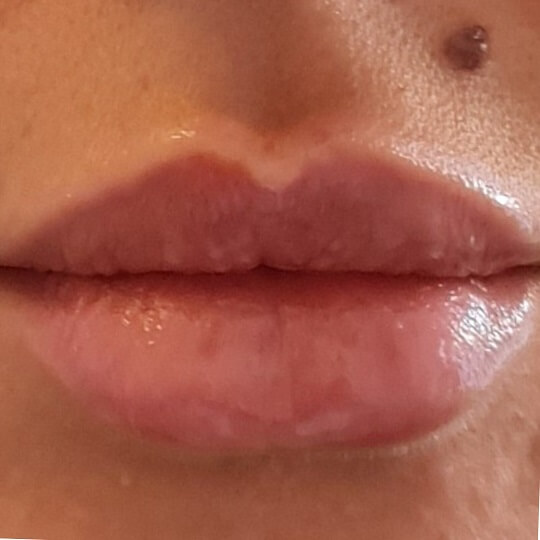 lips20 compressed