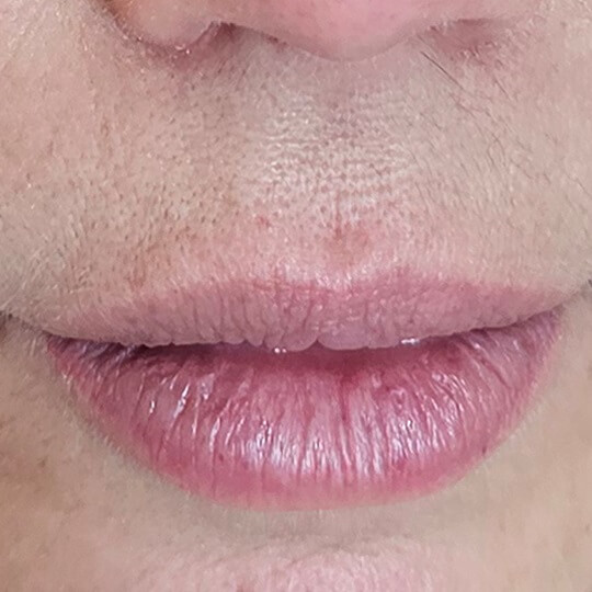 lips10rasamatiiwietgoiswerudgtyh5eo compressed