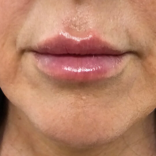 lips23 compressed